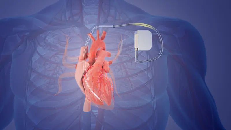 Are Medical Scans Safe with a Pacemaker or Implanted Device